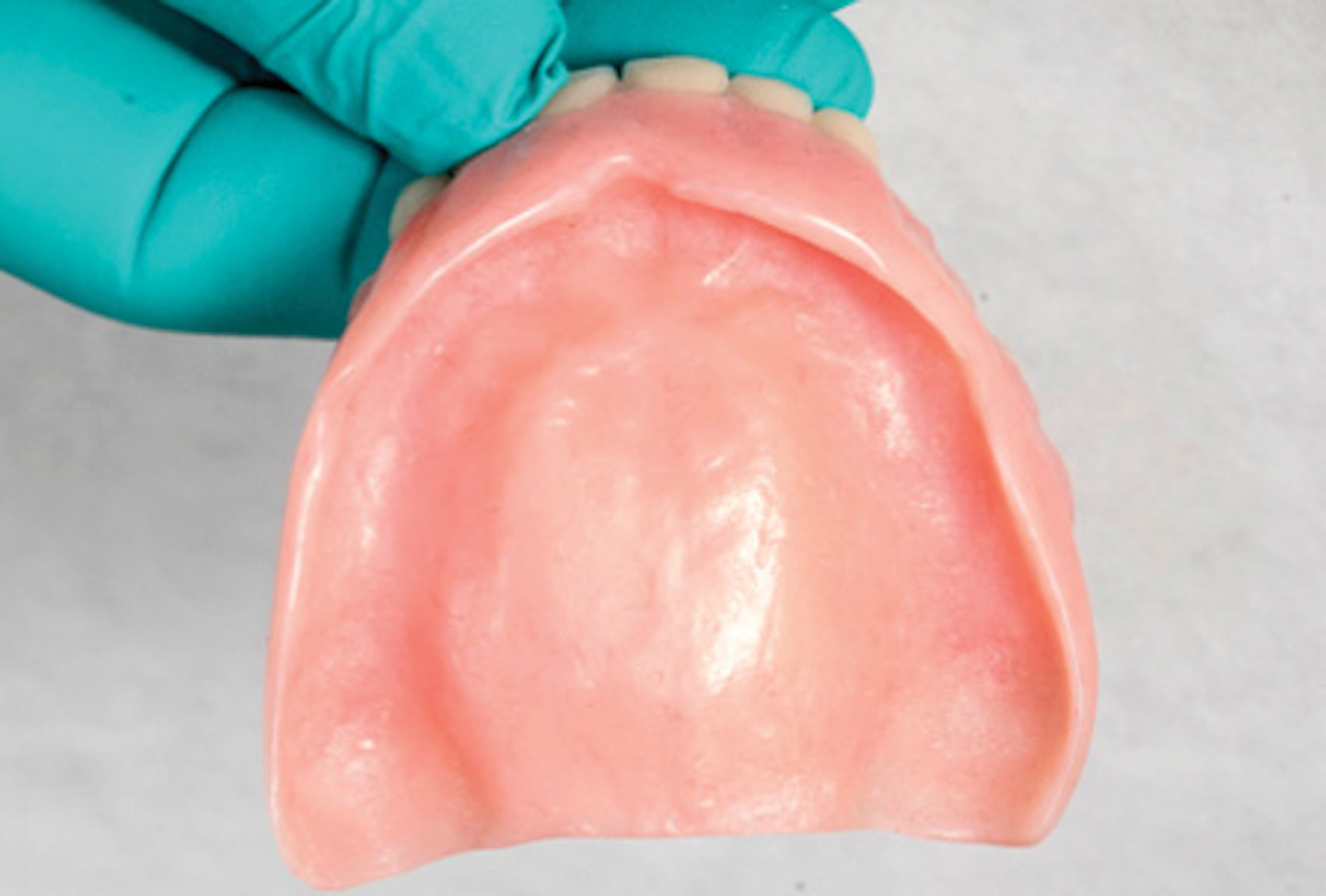 Polyphosphazenebased resilient denture liners A definitive solution