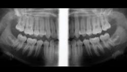 1805dechr P03 1805dechr P03