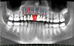 1805degle P02 1805degle P02