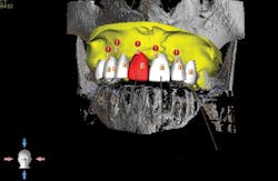 1805degle P03 1805degle P03