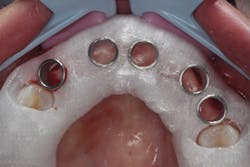 1805degle P05 1805degle P05