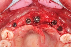 1805degle P06 1805degle P06