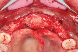 1805degle P07 1805degle P07