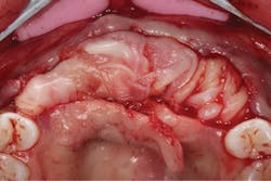 1805degle P08 1805degle P08