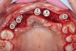 1805degle P09 1805degle P09