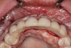 1805degle P10 1805degle P10