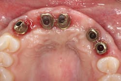 1805degle P14 1805degle P14