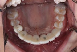 1805degle P15 1805degle P15