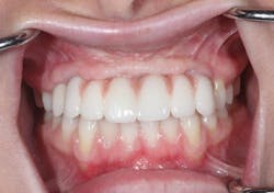 1805degle P16 1805degle P16