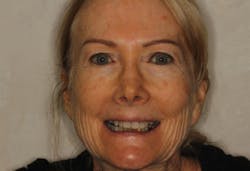 1805denos P01 1805denos P01