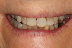 1805denos P02 1805denos P02