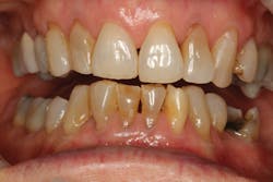 1805denos P03 1805denos P03