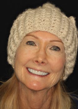 1805denos P04 1805denos P04