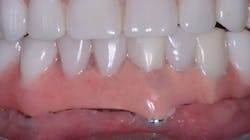 1806dechr P05 1806dechr P05