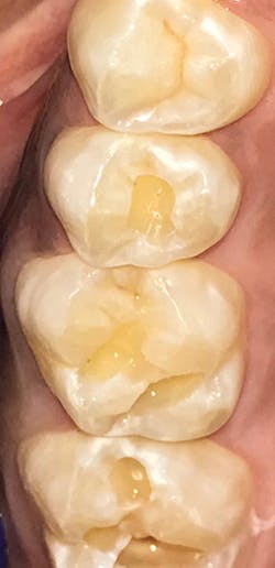 1806delip P01 1806delip P01