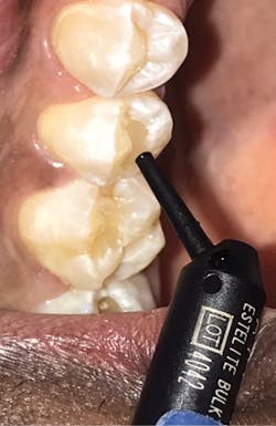 1806delip P02 1806delip P02