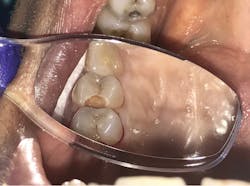 1806delip P03 1806delip P03