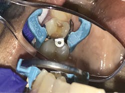 1806delip P04 1806delip P04