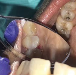 1806delip P05 1806delip P05