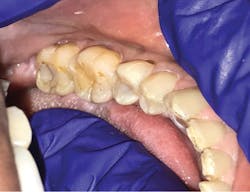 1806delip P06 1806delip P06