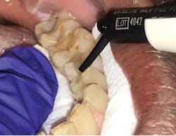 1806delip P07 1806delip P07