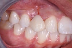 1806demaz P01a 1806demaz P01a