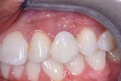 1806demaz P01b 1806demaz P01b