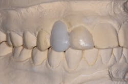 1806demaz P02a 1806demaz P02a