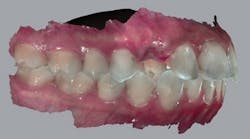 1806demaz P03a 1806demaz P03a