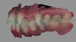 1806demaz P03b 1806demaz P03b