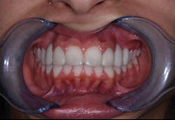 1806demaz P08 1806demaz P08