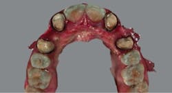 1806demaz P10 1806demaz P10