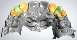 1806demaz P11e 1806demaz P11e