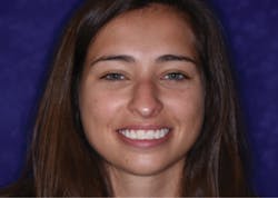 1806demaz P12b 1806demaz P12b