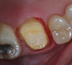 1806deshu P10 1806deshu P10