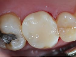 1806deshu P14 1806deshu P14