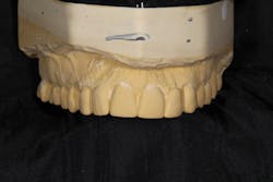 1807decoo P04 1807decoo P04