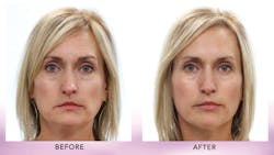 1807demal P01 1807demal P01