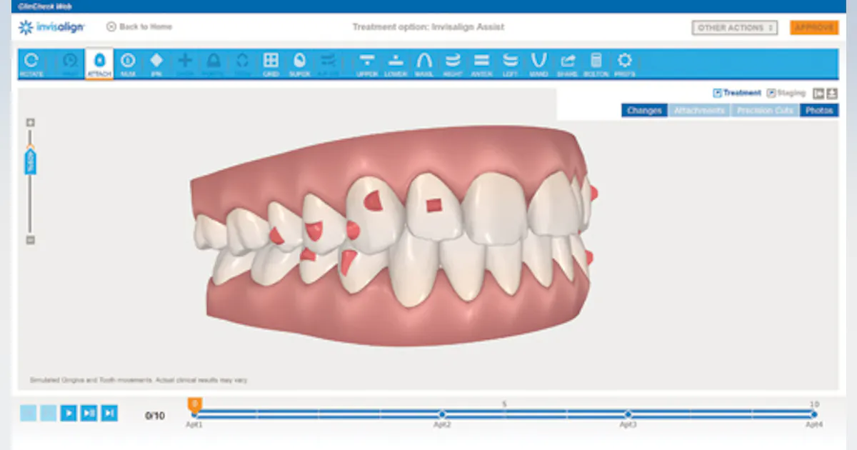 Digital dentistry: Turning dental lab into dental CAD | Dental Economics