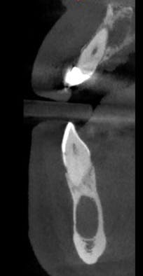 1808denaz P02 1808denaz P02