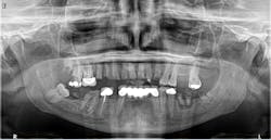 1808denaz P03 1808denaz P03