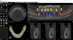 1808denaz P05 1808denaz P05