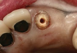 1809debiz P01 1809debiz P01