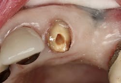 1809debiz P08 1809debiz P08