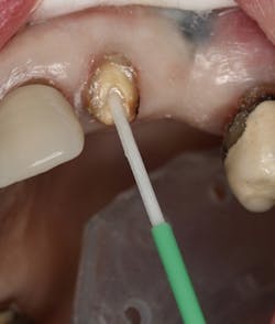 1809debiz P09 1809debiz P09