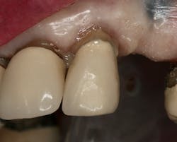 1809debiz P13 1809debiz P13