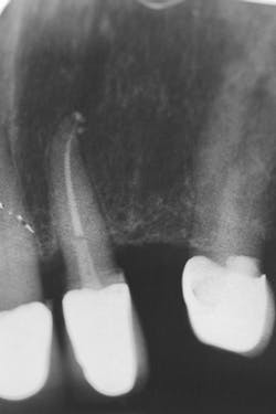 1809debiz P15 1809debiz P15