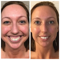 1809demal P01 1809demal P01