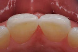 1809demar P04 1809demar P04