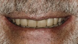 1810debur P01 1810debur P01